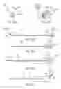 Fig. 20 - Apparatus and method for placement of device along wall of a body lumen
