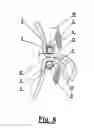 Fig. 04 - Left atrial appendage occlusion device