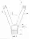 Fig. 03 - Method of transradial catheterization, device for ulnar artery compression, and method of use