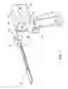 Fig. 02 - Integrated cutting guide and surgical saw blade assembly, the cutting guide including a moveable head that constrains the movement of the blade assembly