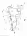 Fig. 10 - Integrated cutting guide and surgical saw blade assembly, the cutting guide including a moveable head that constrains the movement of the blade assembly