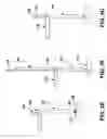 Fig. 06 - Surgical tools having application for spinal surgical procedures and method of use