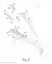 Fig. 05 - Femoral system handle surgical instrument and method of assembling same