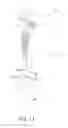 Fig. 11 - Femoral system handle surgical instrument and method of assembling same