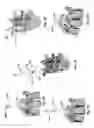 Fig. 06 - Patient-matched apparatus and methods for performing surgical procedures