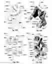 Fig. 43 - Patient-matched apparatus and methods for performing surgical procedures