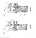 Fig. 15 - Patient-Matched Apparatus and Methods for Performing Surgical Procedures