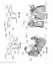 Fig. 31 - Patient-Matched Apparatus and Methods for Performing Surgical Procedures