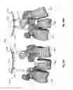 Fig. 40 - Patient-Matched Apparatus and Methods for Performing Surgical Procedures