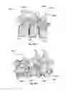 Fig. 52 - Patient-Matched Apparatus and Methods for Performing Surgical Procedures