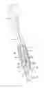 Fig. 03 - Medical knife