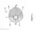 Fig. 04 - Vibration and inertia enhanced atherectomy