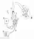 Fig. 02 - Catheter with remotely extendible instruments