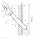 Fig. 09 - COLLAPSIBLE SHEATH AND TAPERED DILATOR FOR TISSUE PUNCTURE ACCESS