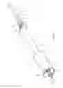 Fig. 09 - General uterine manipulator and system