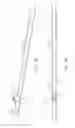Fig. 03 - Spinal implant system and method