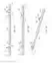 Fig. 05 - Spinal implant system and method