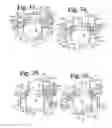 Fig. 10 - Pivotal bone anchor with collet retainer and inner locking insert