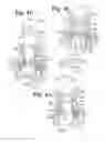 Fig. 12 - Pivotal bone anchor with collet retainer and inner locking insert