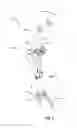 Fig. 03 - Systems and methods for fusing a sacroiliac joint and anchoring an orthopedic appliance