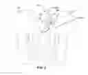Fig. 04 - Systems and methods for fusing a sacroiliac joint and anchoring an orthopedic appliance