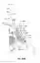 Fig. 110 - Systems and methods for fusing a sacroiliac joint and anchoring an orthopedic appliance