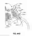 Fig. 112 - Systems and methods for fusing a sacroiliac joint and anchoring an orthopedic appliance