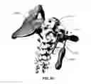 Fig. 136 - Systems and methods for fusing a sacroiliac joint and anchoring an orthopedic appliance