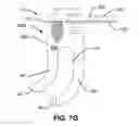 Fig. 14 - Systems and methods for fusing a sacroiliac joint and anchoring an orthopedic appliance
