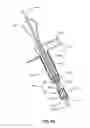 Fig. 149 - Systems and methods for fusing a sacroiliac joint and anchoring an orthopedic appliance