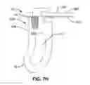 Fig. 15 - Systems and methods for fusing a sacroiliac joint and anchoring an orthopedic appliance