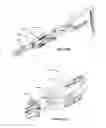 Fig. 151 - Systems and methods for fusing a sacroiliac joint and anchoring an orthopedic appliance