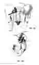 Fig. 158 - Systems and methods for fusing a sacroiliac joint and anchoring an orthopedic appliance
