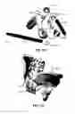 Fig. 170 - Systems and methods for fusing a sacroiliac joint and anchoring an orthopedic appliance