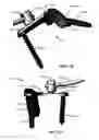 Fig. 173 - Systems and methods for fusing a sacroiliac joint and anchoring an orthopedic appliance