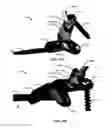 Fig. 182 - Systems and methods for fusing a sacroiliac joint and anchoring an orthopedic appliance