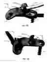 Fig. 183 - Systems and methods for fusing a sacroiliac joint and anchoring an orthopedic appliance