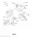 Fig. 19 - Systems and methods for fusing a sacroiliac joint and anchoring an orthopedic appliance