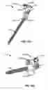 Fig. 196 - Systems and methods for fusing a sacroiliac joint and anchoring an orthopedic appliance