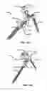 Fig. 197 - Systems and methods for fusing a sacroiliac joint and anchoring an orthopedic appliance