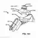 Fig. 201 - Systems and methods for fusing a sacroiliac joint and anchoring an orthopedic appliance