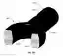 Fig. 247 - Systems and methods for fusing a sacroiliac joint and anchoring an orthopedic appliance