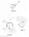 Fig. 27 - Systems and methods for fusing a sacroiliac joint and anchoring an orthopedic appliance