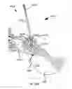 Fig. 276 - Systems and methods for fusing a sacroiliac joint and anchoring an orthopedic appliance