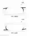 Fig. 281 - Systems and methods for fusing a sacroiliac joint and anchoring an orthopedic appliance