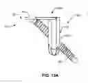 Fig. 29 - Systems and methods for fusing a sacroiliac joint and anchoring an orthopedic appliance
