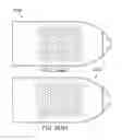 Fig. 291 - Systems and methods for fusing a sacroiliac joint and anchoring an orthopedic appliance
