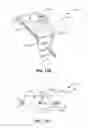 Fig. 30 - Systems and methods for fusing a sacroiliac joint and anchoring an orthopedic appliance