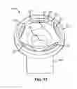 Fig. 35 - Systems and methods for fusing a sacroiliac joint and anchoring an orthopedic appliance