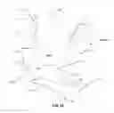 Fig. 40 - Systems and methods for fusing a sacroiliac joint and anchoring an orthopedic appliance